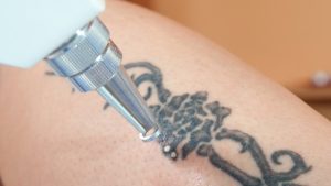 Could The Tattoo That’s Cool Today, Make You Sick In The Future?