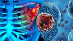 The Promising Science of Stem Cell Therapy: Unleashing the Healing Power Within