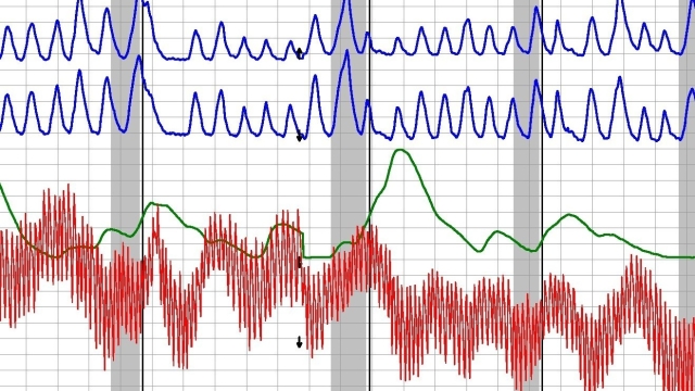 Uncovering Truth: The Power of Lie Detector Tests